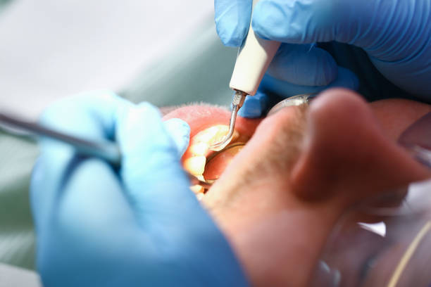 Best Emergency Treatment for Dental Infections or Abscesses in Fountainhead Orchard Hills, MD