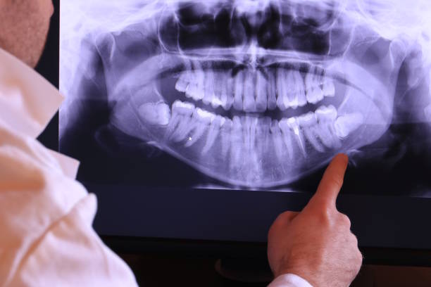 Best Emergency Dental Care for Broken or Chipped Teeth in Fountainhead Orchard Hills, MD